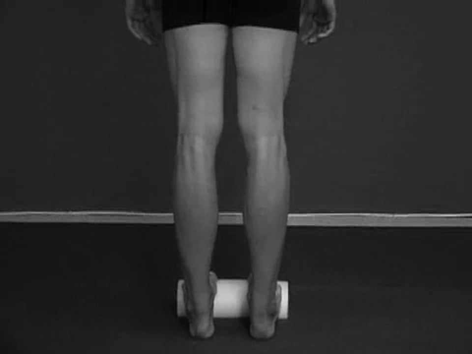 Rheumatoid Arthritis of the Lower Leg